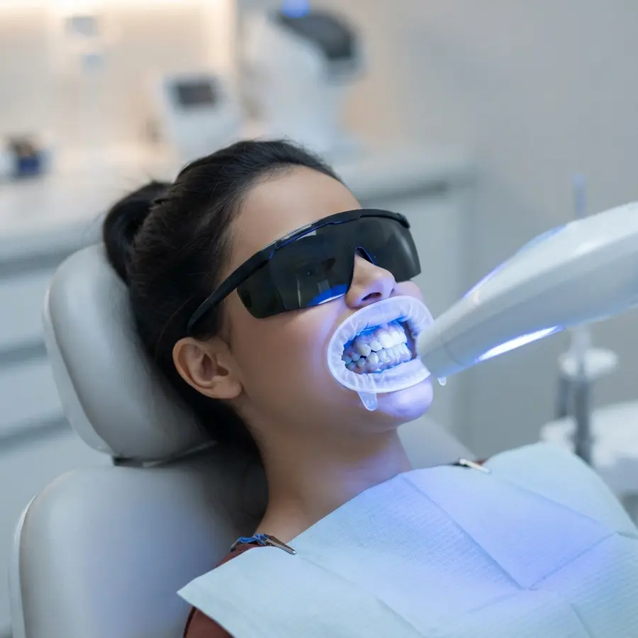Imagem ilustrativa de Clareamento dental